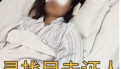 县委宣传部回应“女子称漂流时遭水枪击伤眼睛”：系玩具水枪，伤人者配合警方没逃逸